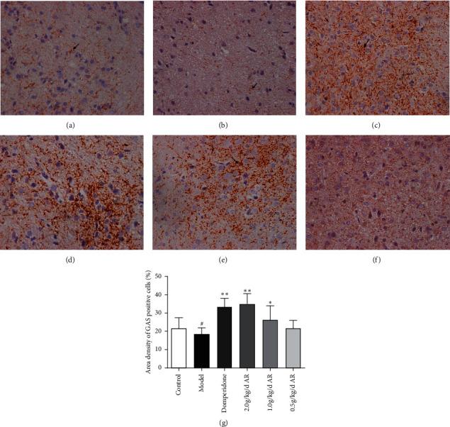 https://cdn.ncbi.nlm.nih.gov/pmc/blobs/1c4f/7685828/87692068c361/ECAM2020-2528617.008.jpg