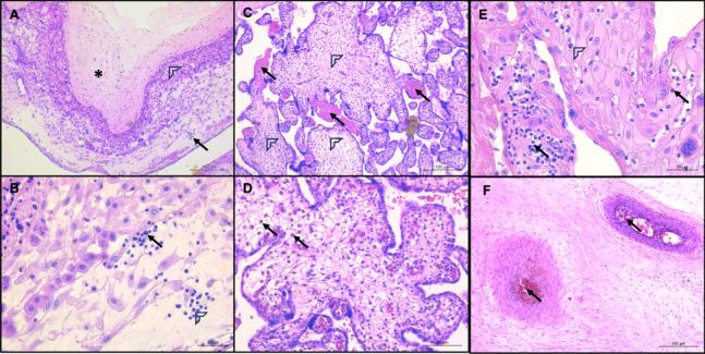 https://cdn.ncbi.nlm.nih.gov/pmc/blobs/1c54/11044384/022643d6b293/12884_2024_6530_Fig1_HTML.jpg
