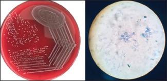 https://cdn.ncbi.nlm.nih.gov/pmc/blobs/1c5c/7842462/1c4bb77c7e7e/JFMPC-9-5776-g001.jpg