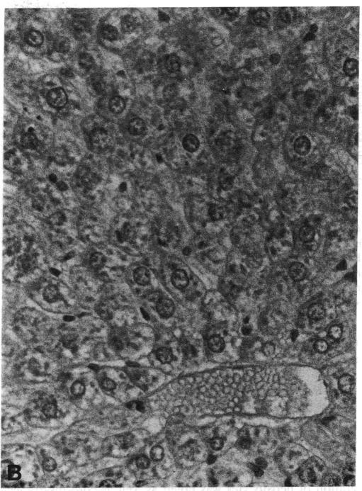 https://cdn.ncbi.nlm.nih.gov/pmc/blobs/1c60/287955/eef8fae0d65d/jcinvest00037-0091-a.jpg