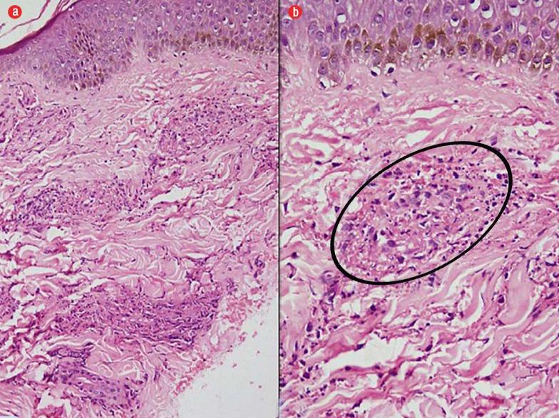 https://cdn.ncbi.nlm.nih.gov/pmc/blobs/1c62/6330183/92bf9bdf5606/OMJ-D-17-00039-f3.jpg