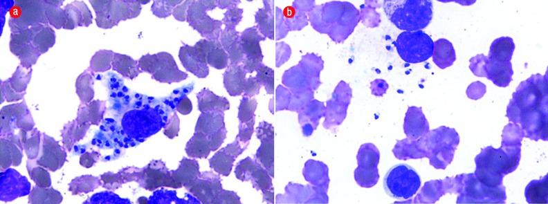 https://cdn.ncbi.nlm.nih.gov/pmc/blobs/1c62/6330183/d34377e32b6d/OMJ-D-17-00039-f2.jpg
