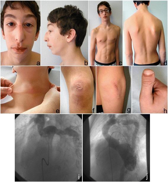 https://cdn.ncbi.nlm.nih.gov/pmc/blobs/1c63/4412100/4eb10016c1db/12881_2014_122_Fig1_HTML.jpg