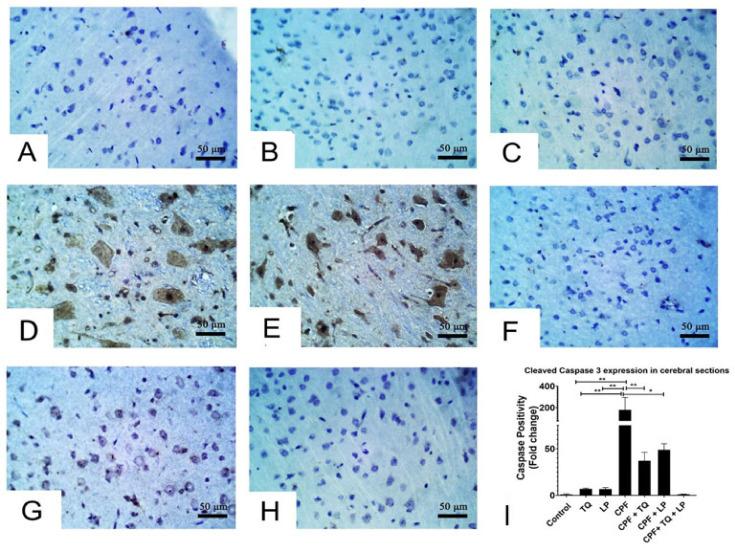 https://cdn.ncbi.nlm.nih.gov/pmc/blobs/1c67/8468258/8f55ead42d06/pharmaceuticals-14-00940-g005.jpg