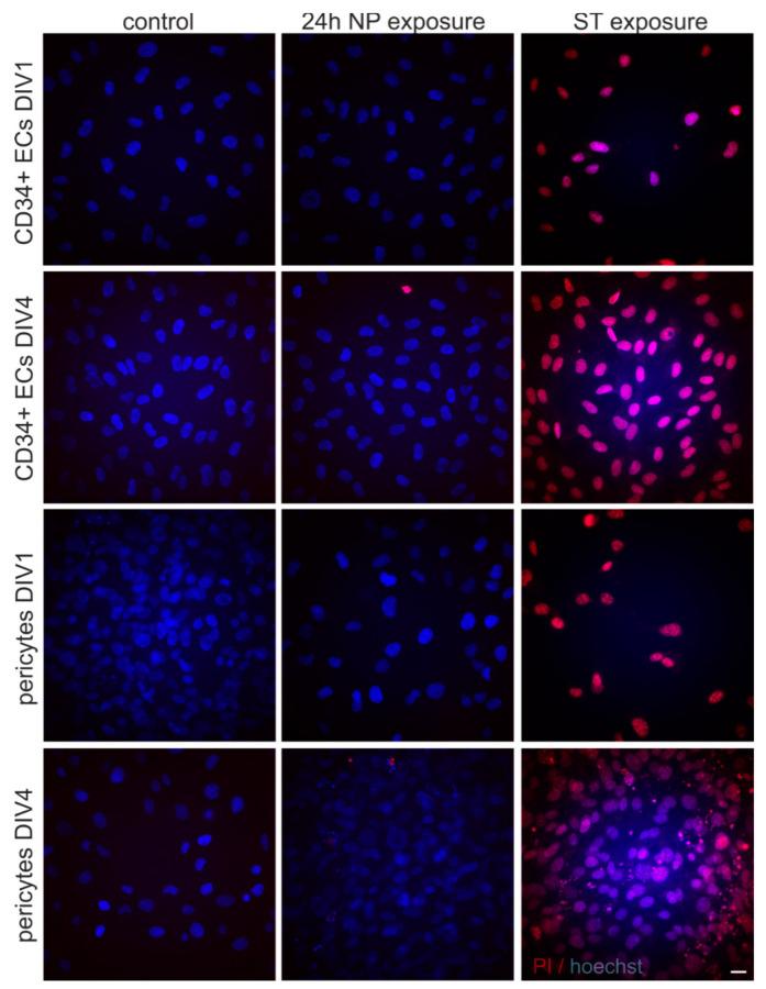 https://cdn.ncbi.nlm.nih.gov/pmc/blobs/1c68/7915594/aba656730071/ijms-22-01657-g0A1.jpg