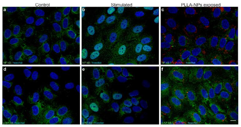 https://cdn.ncbi.nlm.nih.gov/pmc/blobs/1c68/7915594/cd52a65f922a/ijms-22-01657-g004.jpg