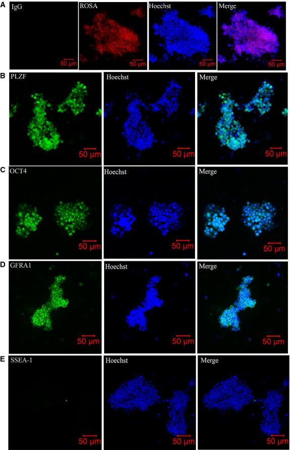 https://cdn.ncbi.nlm.nih.gov/pmc/blobs/1c6a/4369810/f7a7040814d0/jcmm0019-0521-f1.jpg