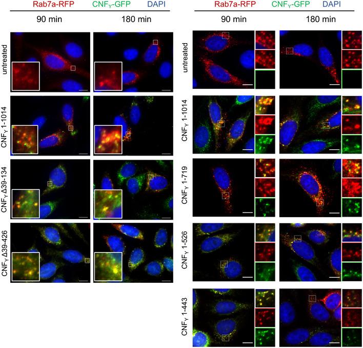 https://cdn.ncbi.nlm.nih.gov/pmc/blobs/1c6e/7883292/c399fc3418db/EMBJ-40-e105202-g008.jpg