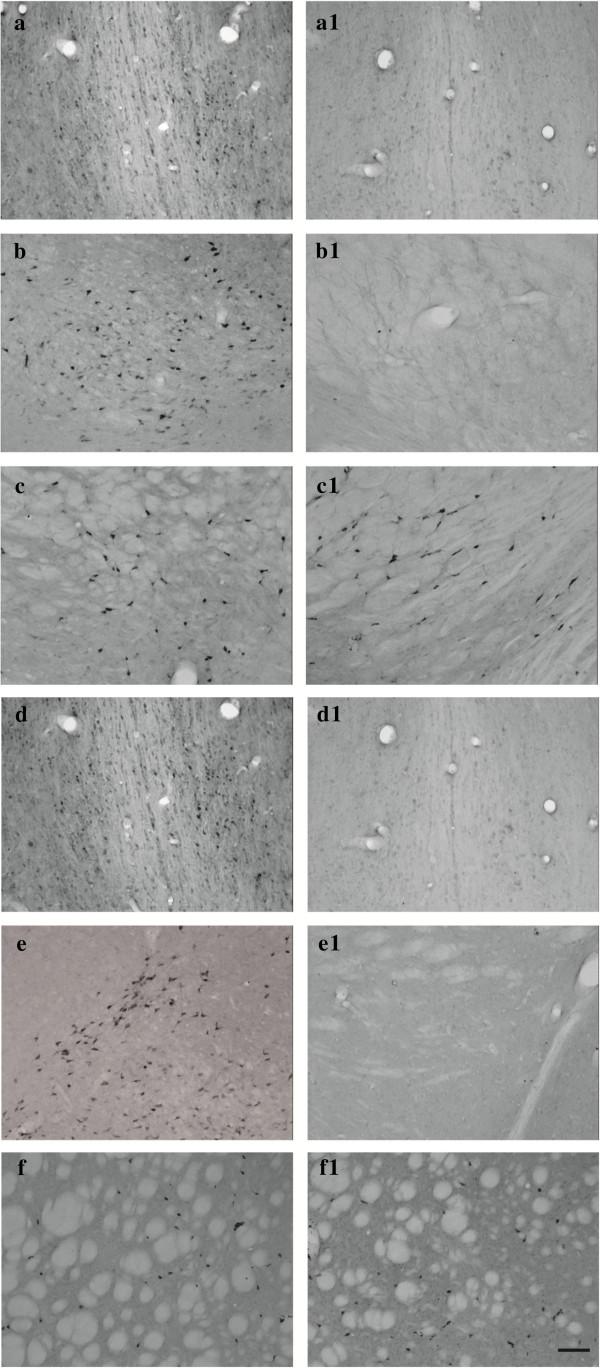 https://cdn.ncbi.nlm.nih.gov/pmc/blobs/1c6f/3978431/b4e323e9e234/alzrt215-2.jpg
