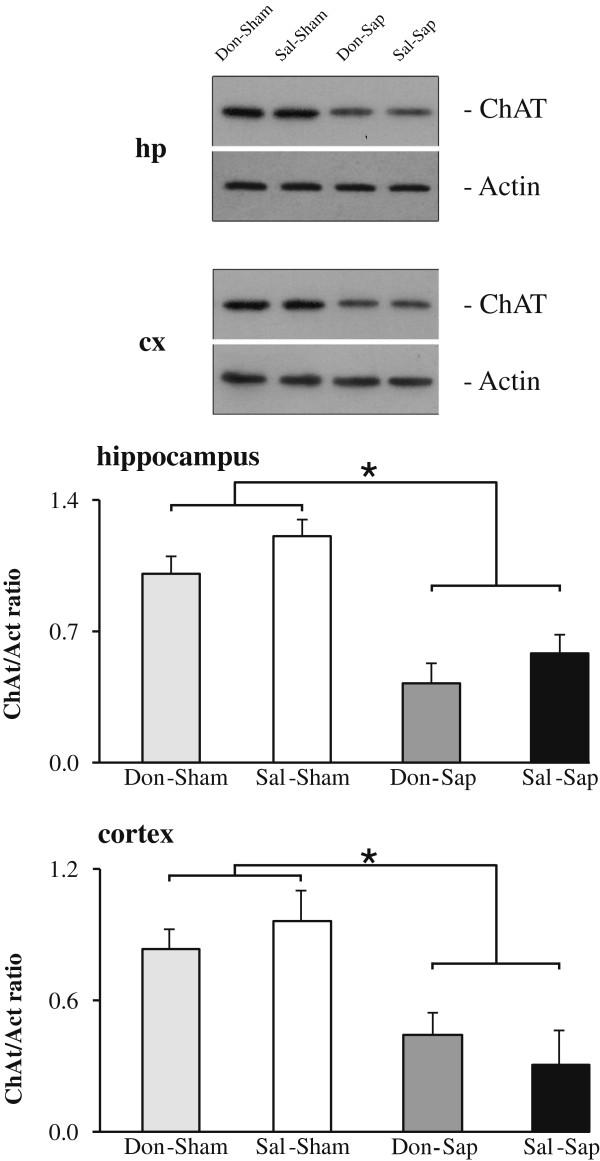 https://cdn.ncbi.nlm.nih.gov/pmc/blobs/1c6f/3978431/c63214cbb9a8/alzrt215-3.jpg