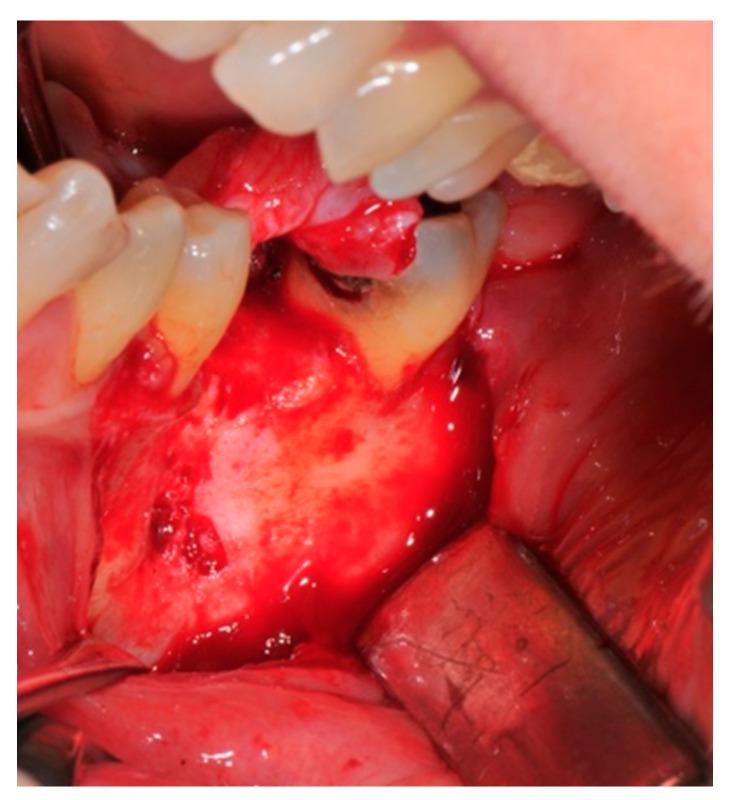 https://cdn.ncbi.nlm.nih.gov/pmc/blobs/1c75/7826518/d1e47e1bd72e/medicina-57-00060-g005.jpg