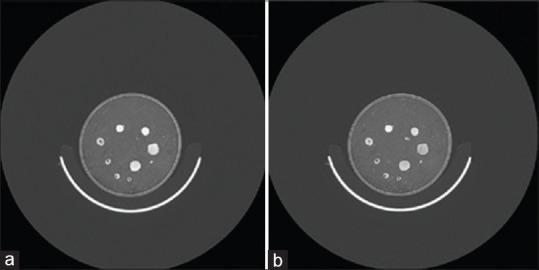 https://cdn.ncbi.nlm.nih.gov/pmc/blobs/1c82/8804592/cf1825a2410e/JMSS-12-64-g005.jpg