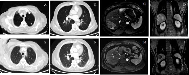 https://cdn.ncbi.nlm.nih.gov/pmc/blobs/1c87/9388744/5dd4ed88cb62/fimmu-13-929141-g004.jpg