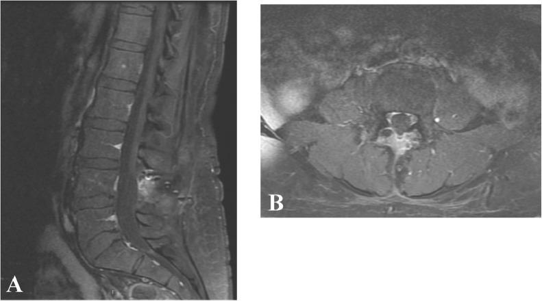 https://cdn.ncbi.nlm.nih.gov/pmc/blobs/1c89/7753083/7ba6bfe011ad/gr4.jpg
