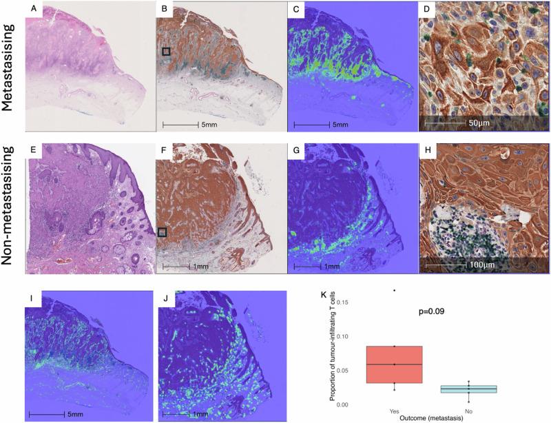 https://cdn.ncbi.nlm.nih.gov/pmc/blobs/1c8d/12405460/15db1b56cd23/41698_2025_1065_Fig5_HTML.jpg
