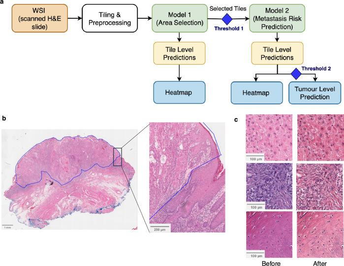 https://cdn.ncbi.nlm.nih.gov/pmc/blobs/1c8d/12405460/330e9f72b8e4/41698_2025_1065_Fig1_HTML.jpg