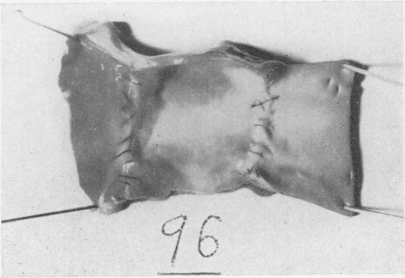 https://cdn.ncbi.nlm.nih.gov/pmc/blobs/1c90/1451111/46ce6fe9383b/annsurg01237-0089-a.jpg