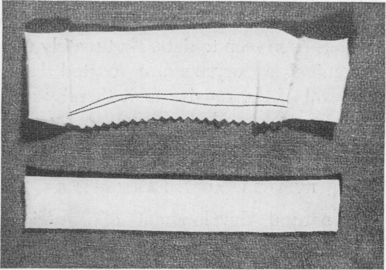 https://cdn.ncbi.nlm.nih.gov/pmc/blobs/1c90/1451111/dddd5bcfa31a/annsurg01237-0091-b.jpg