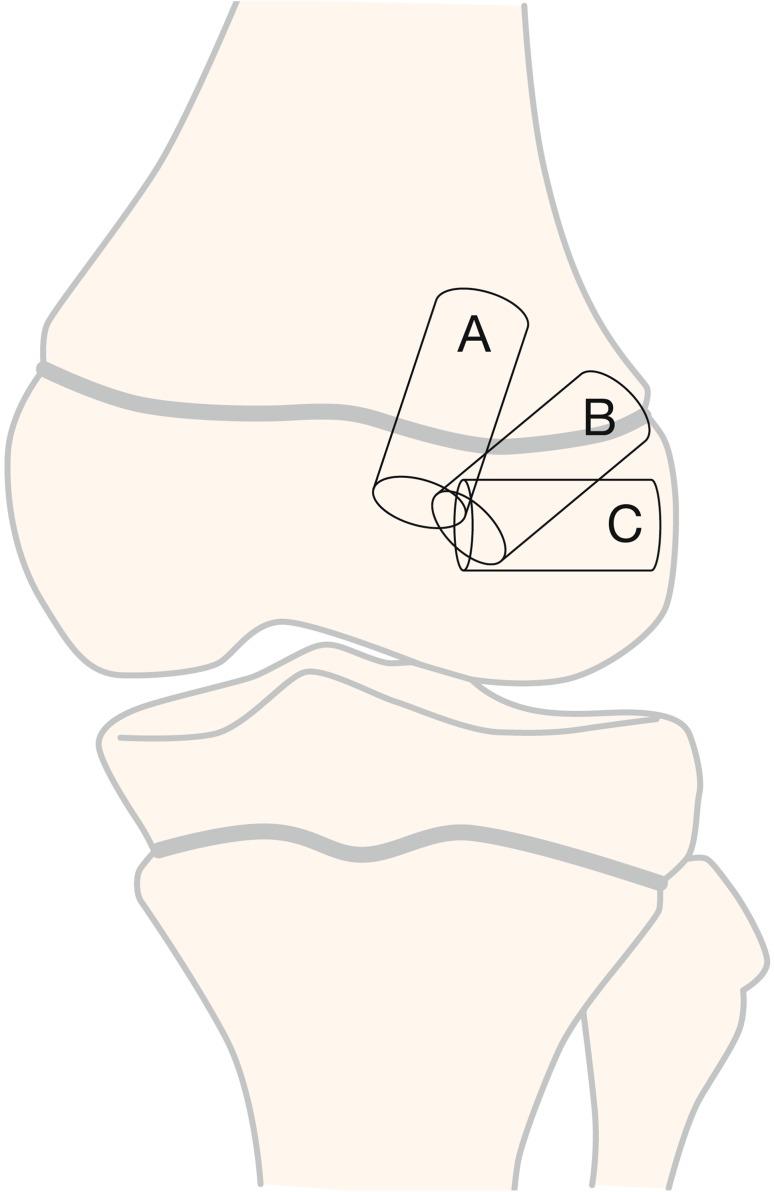 https://cdn.ncbi.nlm.nih.gov/pmc/blobs/1c90/5876259/78a88e232ed9/167_2018_4865_Fig8_HTML.jpg