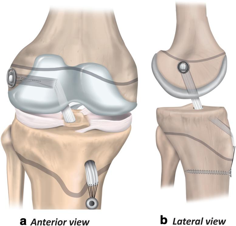 https://cdn.ncbi.nlm.nih.gov/pmc/blobs/1c90/5876259/8d3abe5cb143/167_2018_4865_Fig6_HTML.jpg