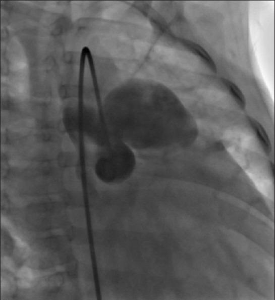https://cdn.ncbi.nlm.nih.gov/pmc/blobs/1c91/3503352/6407f3bba235/HV-13-103-g002.jpg