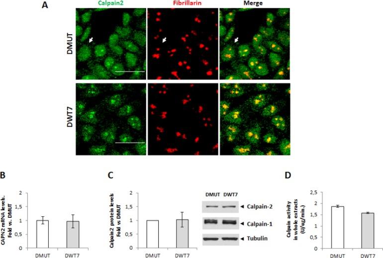 https://cdn.ncbi.nlm.nih.gov/pmc/blobs/1c96/5823616/3baf6a598546/oncotarget-09-9100-g005.jpg
