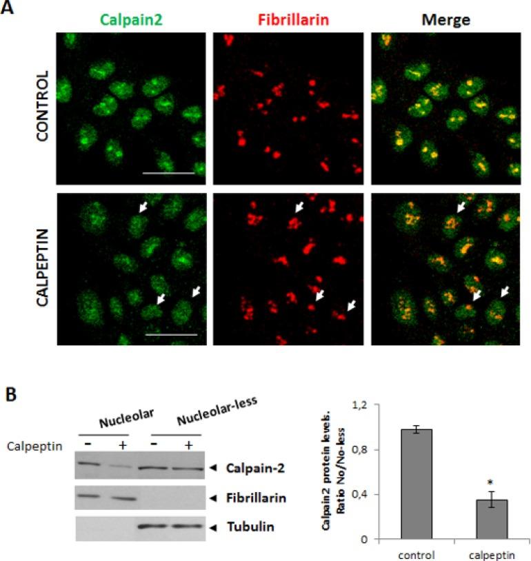 https://cdn.ncbi.nlm.nih.gov/pmc/blobs/1c96/5823616/9319dce3a7ec/oncotarget-09-9100-g003.jpg
