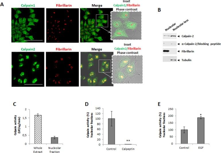 https://cdn.ncbi.nlm.nih.gov/pmc/blobs/1c96/5823616/a61a968efb05/oncotarget-09-9100-g001.jpg