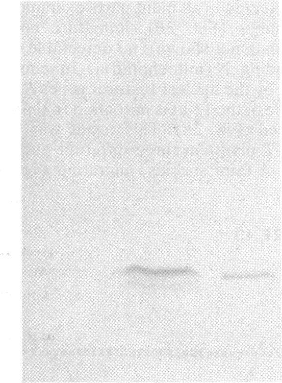https://cdn.ncbi.nlm.nih.gov/pmc/blobs/1c97/298858/ab703067ce29/pnas00330-0298-c.jpg