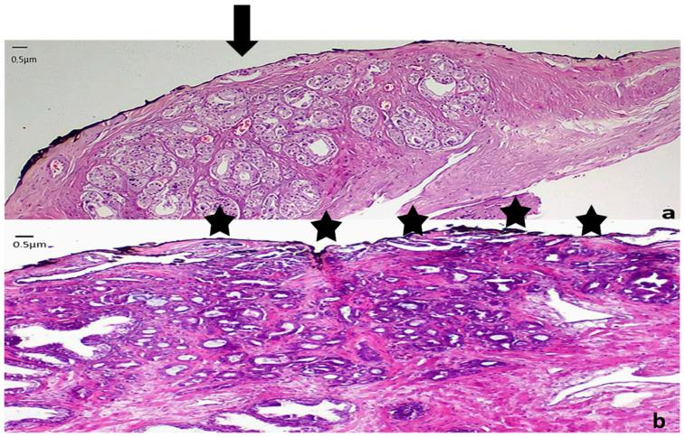 https://cdn.ncbi.nlm.nih.gov/pmc/blobs/1c97/8749855/1f2777215654/cancers-14-00013-g003.jpg