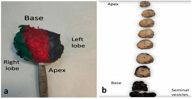 https://cdn.ncbi.nlm.nih.gov/pmc/blobs/1c97/8749855/30116dcb8c7f/cancers-14-00013-g001.jpg