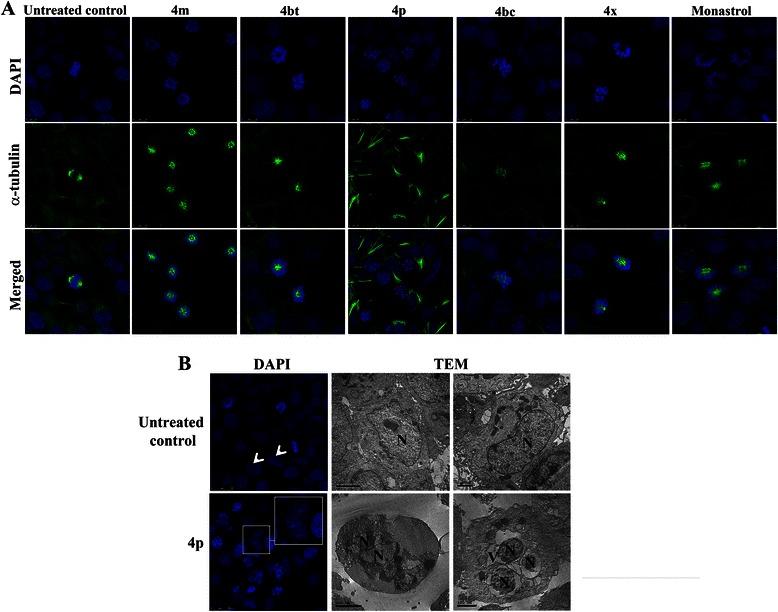 https://cdn.ncbi.nlm.nih.gov/pmc/blobs/1c98/4411898/c022a93295b9/12885_2015_1274_Fig5_HTML.jpg