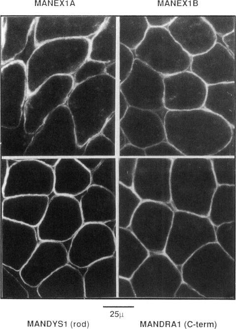 https://cdn.ncbi.nlm.nih.gov/pmc/blobs/1c9f/1682245/ac6011cabf39/ajhg00052-0141-a.jpg
