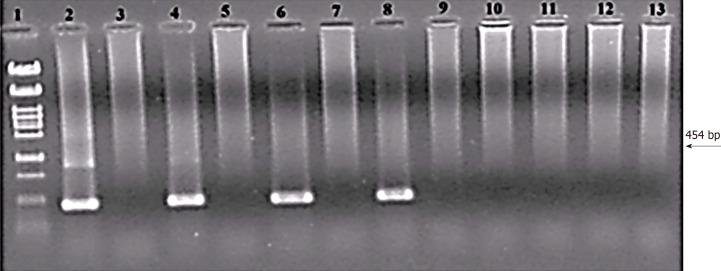 https://cdn.ncbi.nlm.nih.gov/pmc/blobs/1c9f/8613642/302e1d4207f9/WJG-27-7100-g003.jpg