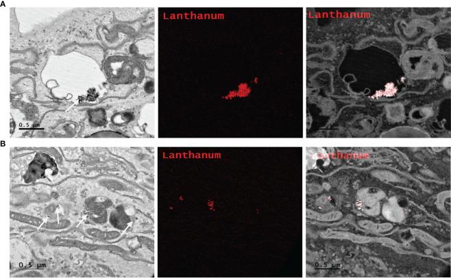 https://cdn.ncbi.nlm.nih.gov/pmc/blobs/1ca9/10494715/2351ce133920/fonc-13-1244709-g008.jpg