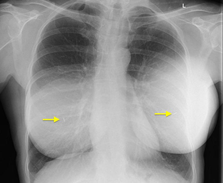 https://cdn.ncbi.nlm.nih.gov/pmc/blobs/1ca9/11140518/a70c8b2400a6/ojad090f1.jpg