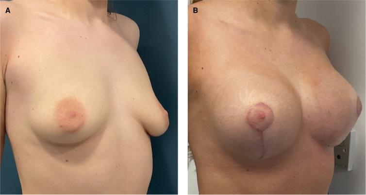 https://cdn.ncbi.nlm.nih.gov/pmc/blobs/1ca9/11140518/ae79c35449cc/ojad090f3.jpg