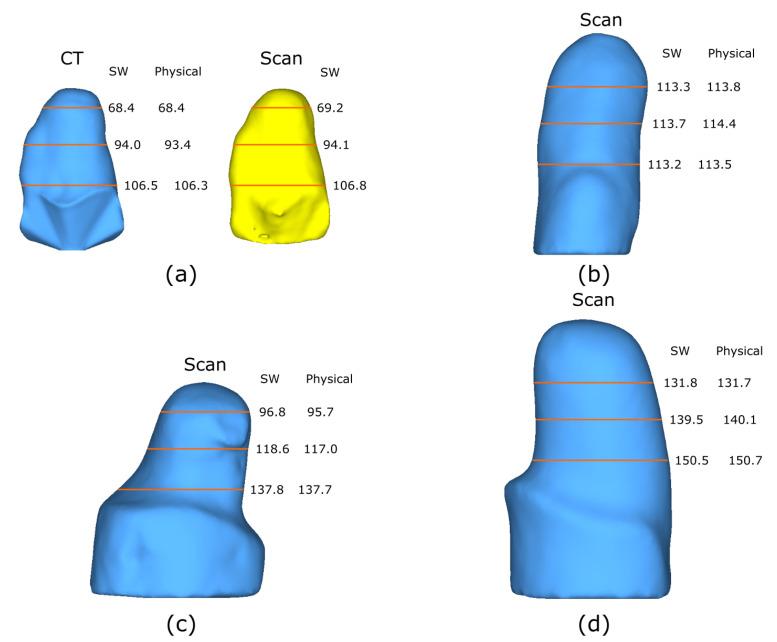 https://cdn.ncbi.nlm.nih.gov/pmc/blobs/1cad/9003530/d753be292879/sensors-22-02443-g014.jpg