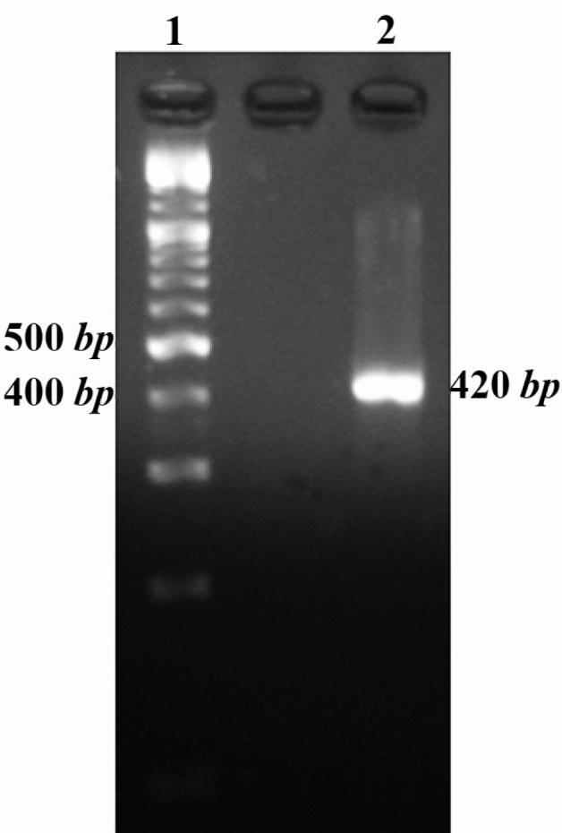 https://cdn.ncbi.nlm.nih.gov/pmc/blobs/1cb3/3558195/32972a177b21/AJMB-3-207-g001.jpg