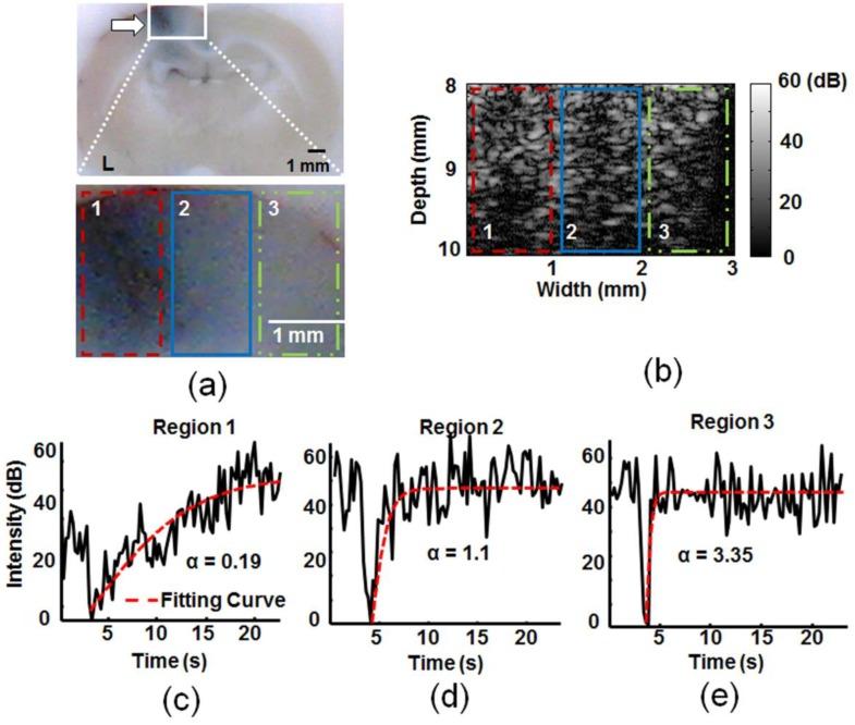 https://cdn.ncbi.nlm.nih.gov/pmc/blobs/1cb8/4143942/2234fd6a4dac/thnov04p1014g004.jpg