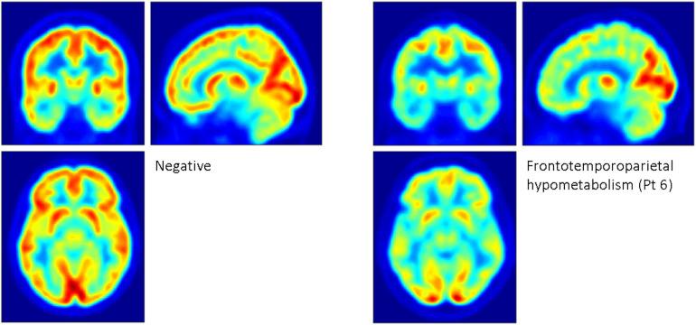 https://cdn.ncbi.nlm.nih.gov/pmc/blobs/1cbe/8248344/0ea744647e32/fnins-15-664525-g001.jpg