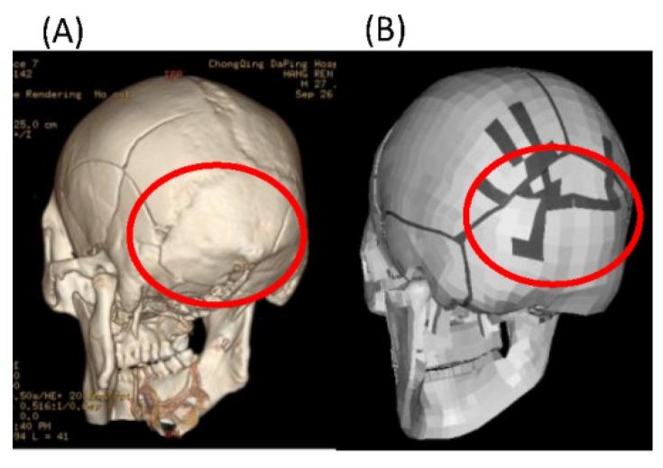 https://cdn.ncbi.nlm.nih.gov/pmc/blobs/1cc1/7177884/d7c48a3e8933/ijerph-17-02392-g005.jpg