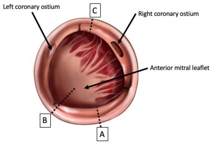 https://cdn.ncbi.nlm.nih.gov/pmc/blobs/1cc5/10531615/c102b7e6d009/jcdd-10-00373-g001.jpg