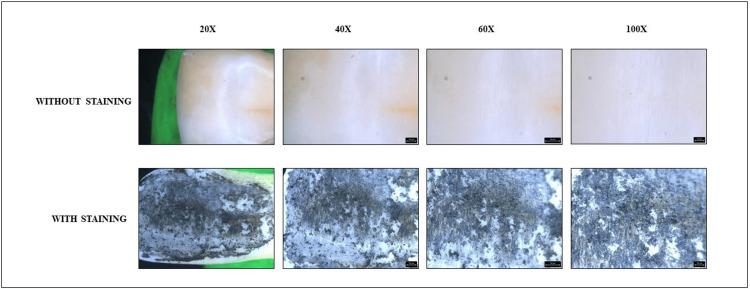 https://cdn.ncbi.nlm.nih.gov/pmc/blobs/1ccf/11144051/e5d0a0dcbae3/cureus-0016-00000059488-i03.jpg