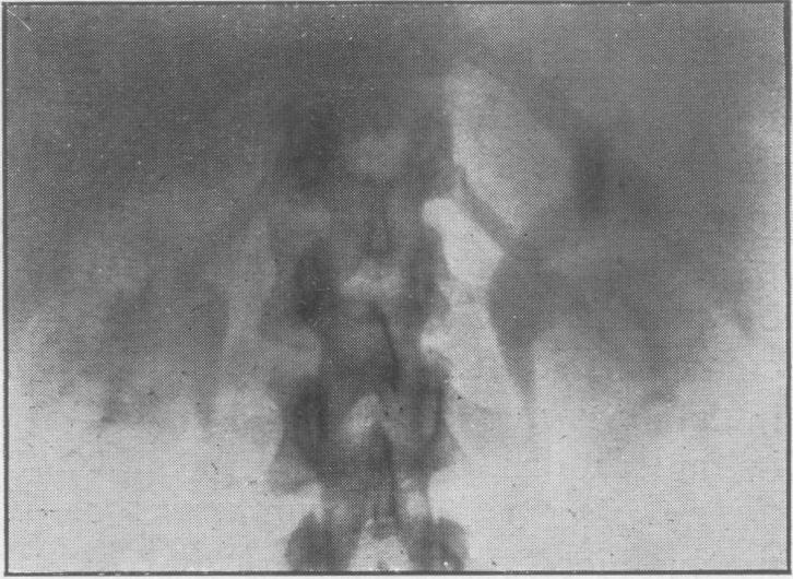 https://cdn.ncbi.nlm.nih.gov/pmc/blobs/1cd2/2183305/f5c3541a4c66/procrsmed00536-0046-c.jpg