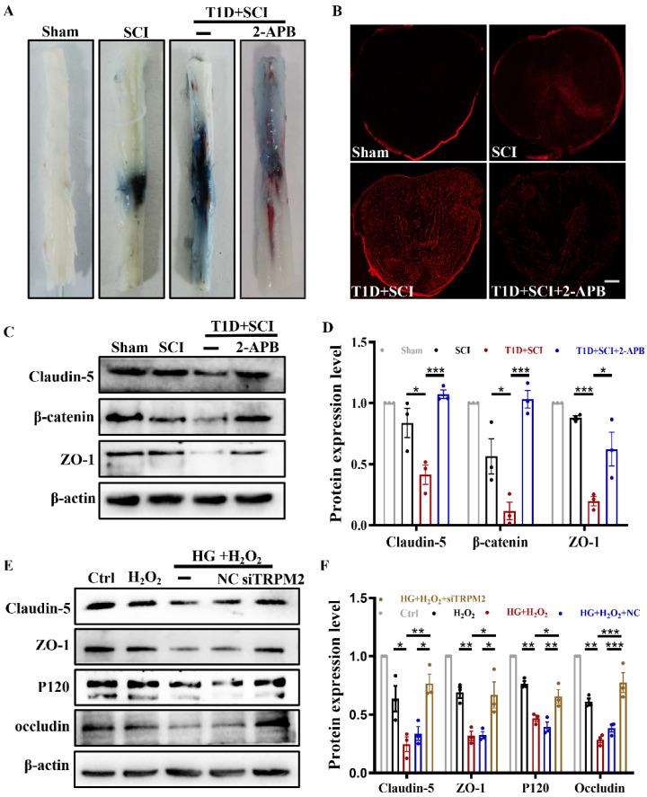 https://cdn.ncbi.nlm.nih.gov/pmc/blobs/1cd7/10197895/4481ca87309a/ijbsv19p2475g008.jpg