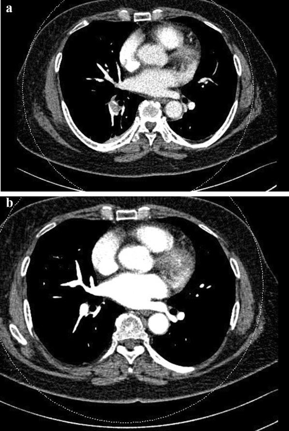 https://cdn.ncbi.nlm.nih.gov/pmc/blobs/1ce2/10801930/46d418414647/43019_2023_207_Fig1_HTML.jpg