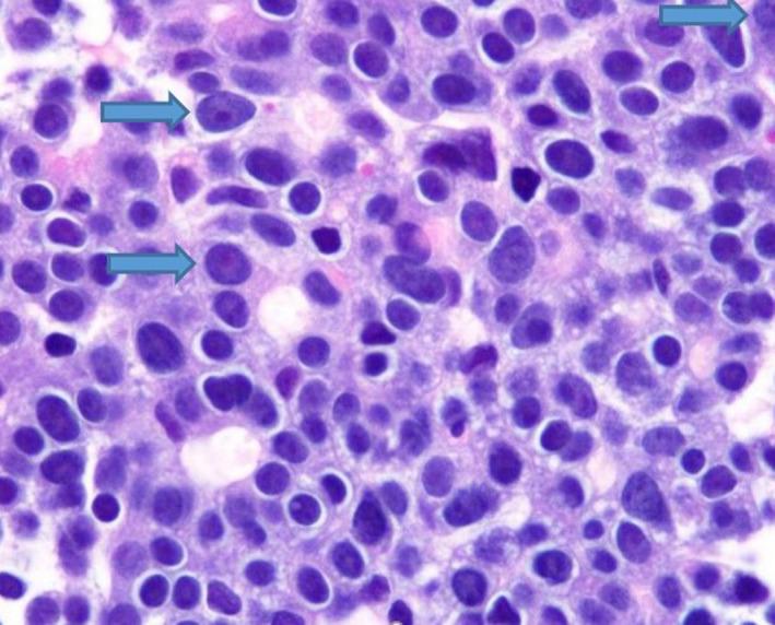 https://cdn.ncbi.nlm.nih.gov/pmc/blobs/1ce4/7250977/662620eb8890/CCR3-8-905-g009.jpg