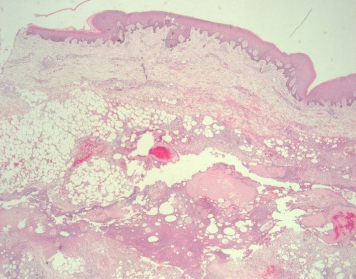 https://cdn.ncbi.nlm.nih.gov/pmc/blobs/1ce4/7250977/b5035559b403/CCR3-8-905-g003.jpg