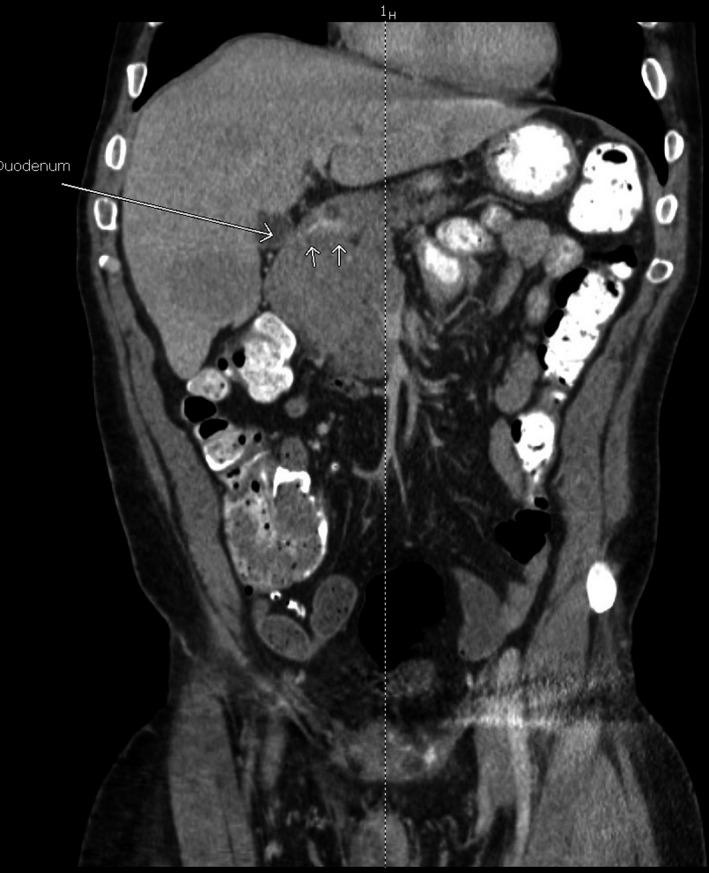 https://cdn.ncbi.nlm.nih.gov/pmc/blobs/1ce4/7250977/ea3f2e2bb4a9/CCR3-8-905-g004.jpg